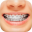 icon android Braces