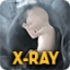 icon android X-Ray Body Scanner