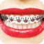 icon android Real Braces Teeth